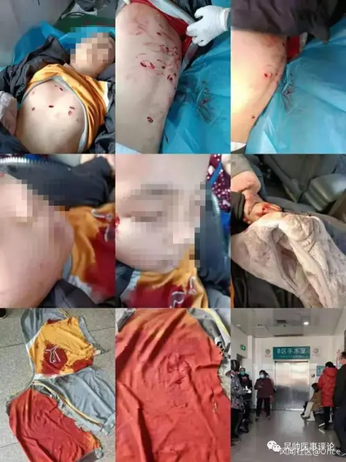 湖南村医9岁儿子竟遭患者连刺50多刀，警方通报：嫌犯被刑拘