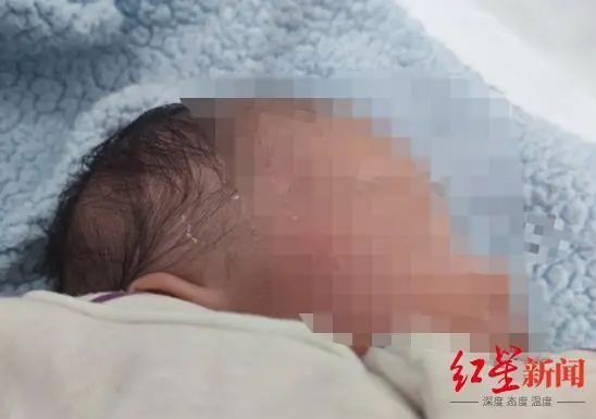 心痛！四川乐山一刚出生40天的女婴草坪上晒太阳，被男童踩伤头部