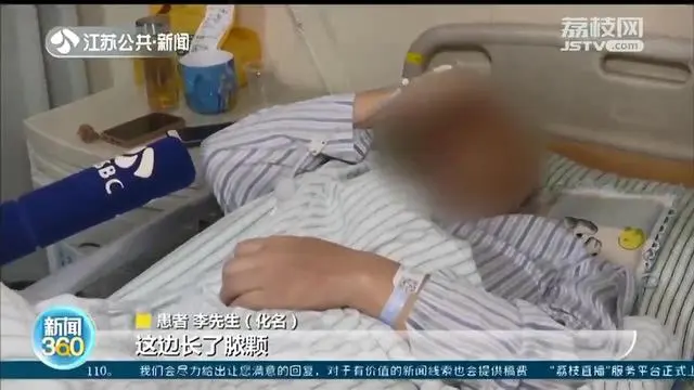 46岁男子挤痘痘 引发颅内脓肿导致瘫痪