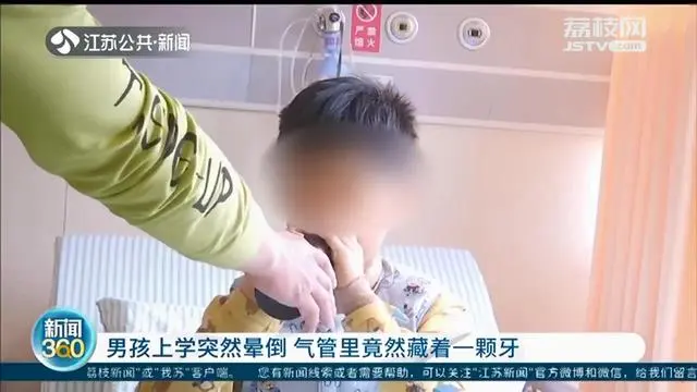 江阴10岁男孩上学突然晕倒 竟然从气管里取出一颗牙