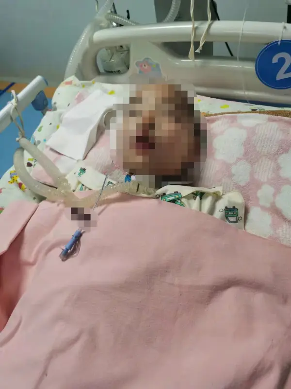 7岁男童拔牙后昏迷40天两度“病危” 家属称曾被医院保安殴打