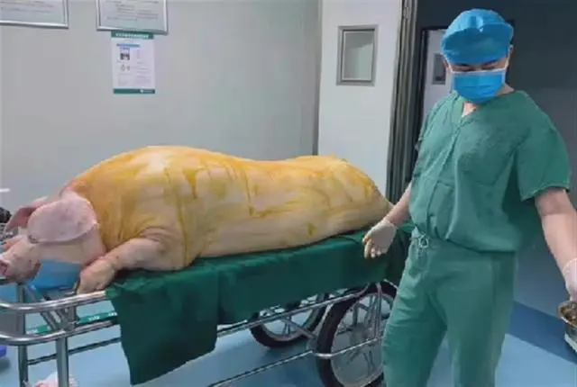 猪躺手术台被剥皮，医院：用于皮肤移植，有患者曾用6头猪