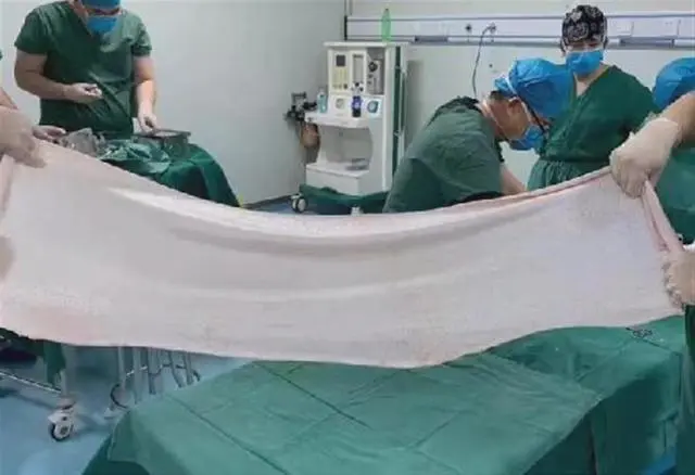 猪躺手术台被剥皮，医院：用于皮肤移植，有患者曾用6头猪
