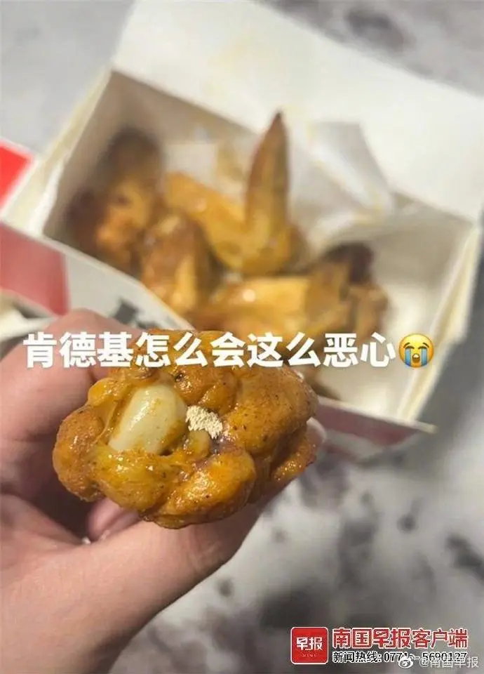 女子称在肯德基鸡腿中吃出虫卵