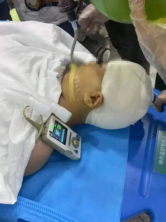 長沙被老師打破頭骨女孩已清醒！家屬被告知：當天監控無法調取