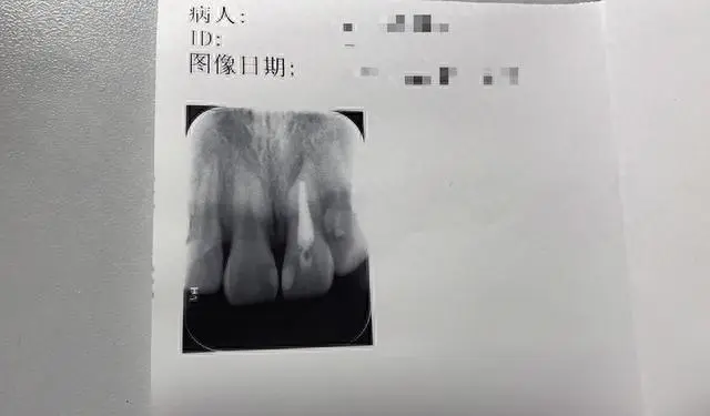 “脆皮大學生”走紅 伸懶腰脖子斷了讓人哭笑不得