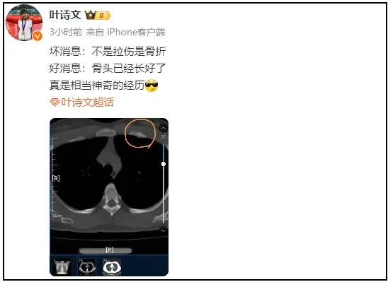 叶诗文今晚发文：不是拉伤是骨折