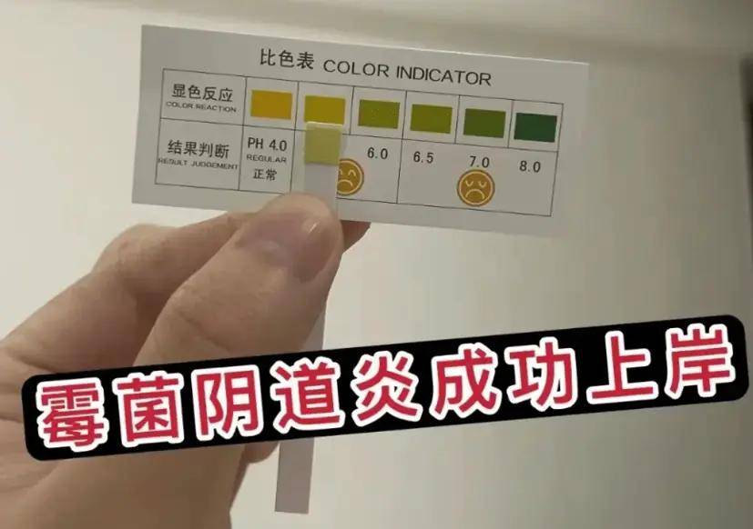 为什么会患霉菌性阴说念炎,这些生计细节频频被忽略