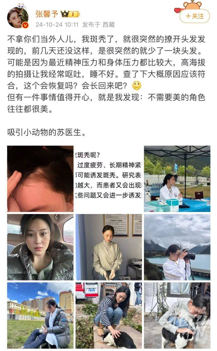 知名女演员自爆“斑秃”，头发还有希望长回来吗？