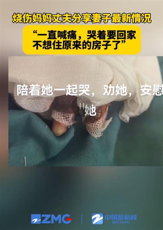 浙江烧伤妈妈一直喊痛，天天哭着想回家，不敢住原来的房子，老公准备学带货自食其力