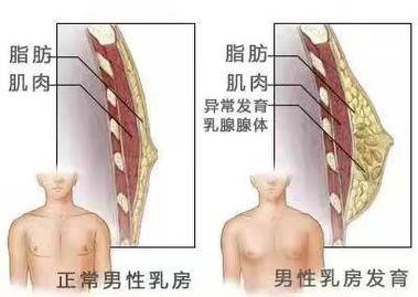 营养不良也是导致男性乳腺发育的重要因素