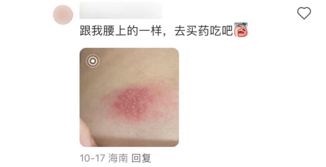 一旦感染终身携带，痛起来如刀割、似火烧！深圳疾控提醒