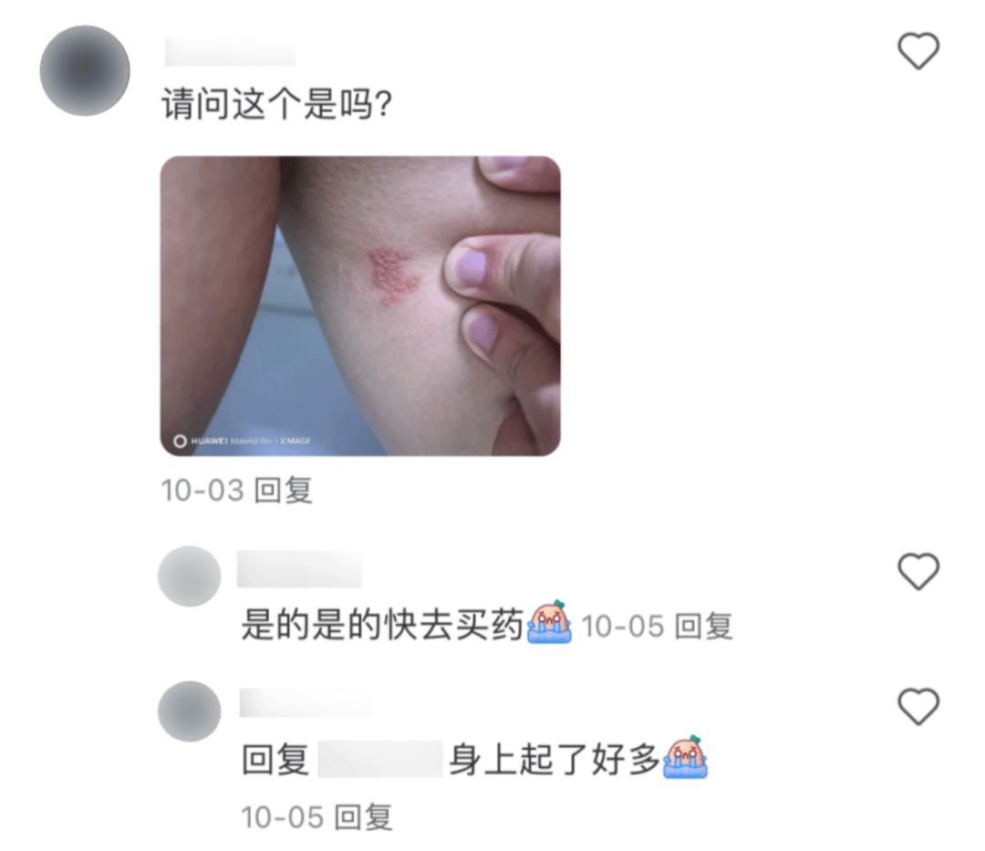 一旦感染终身携带，痛起来如刀割、似火烧！深圳疾控提醒