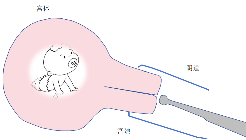 怀孕了，一定要做阴超吗？可以换吗？