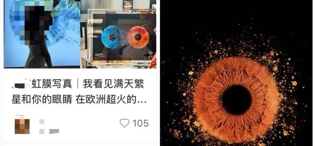 “虹膜写照”倏得爆火！不少东谈主在拍…大夫紧要指示