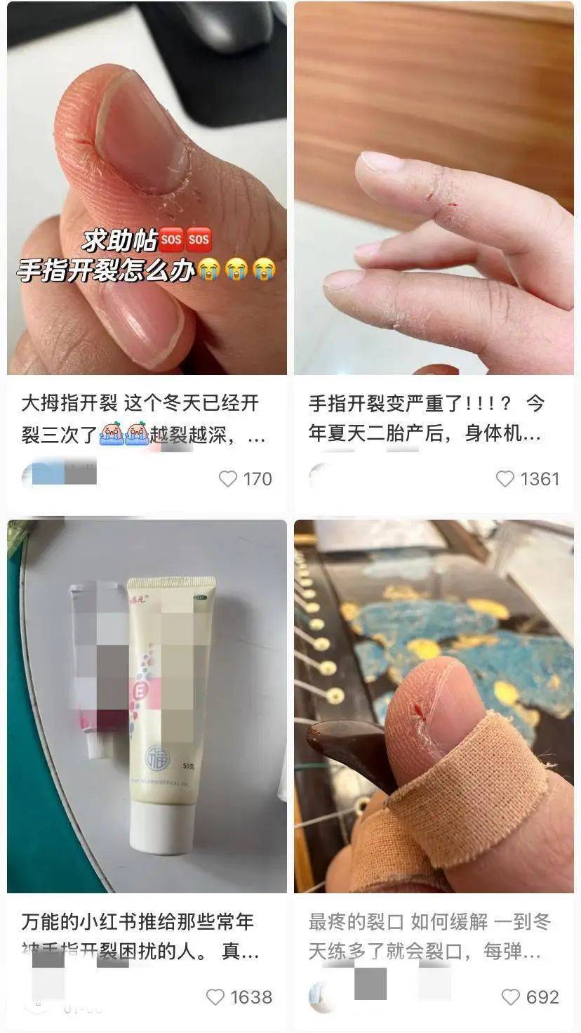 一到冬天手指为啥就开裂脱皮？专家建议抓住“黄金三分钟”