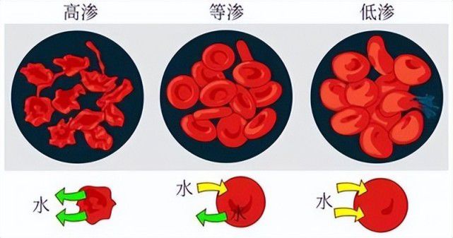 长沙一女子一天喝8杯水，引发致盲眼病！到底喝多少水是安全的？