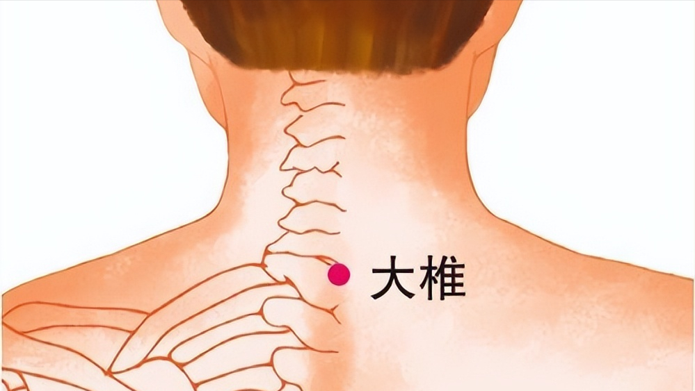 拔火罐吸出来的，到底是淤血还是体内的毒素？看完涨知识