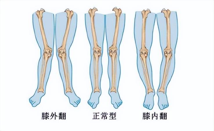 这个病几乎人人躲不开，你知道它是怎么发生的吗？