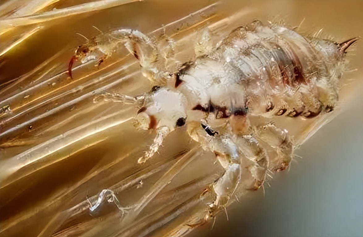 “虱子”与我们共存千万年，为何这几年见不到了？