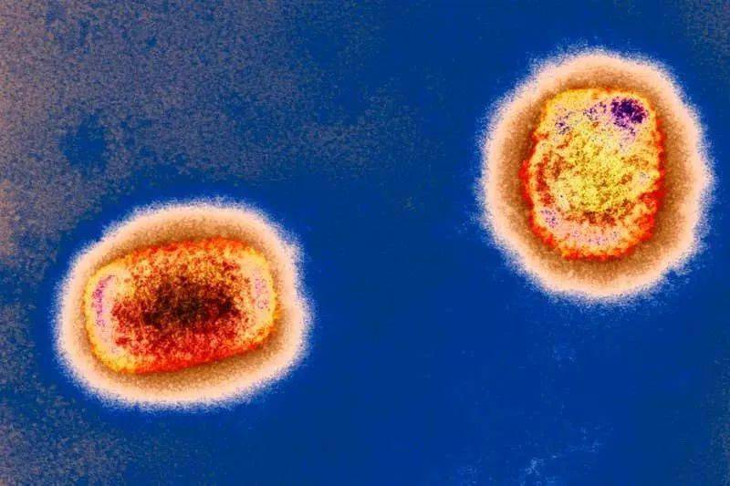 突发警报! 加拿大罕见猴痘感染扩大! 8天传12国 WHO紧急开会 恐已开始社区传播