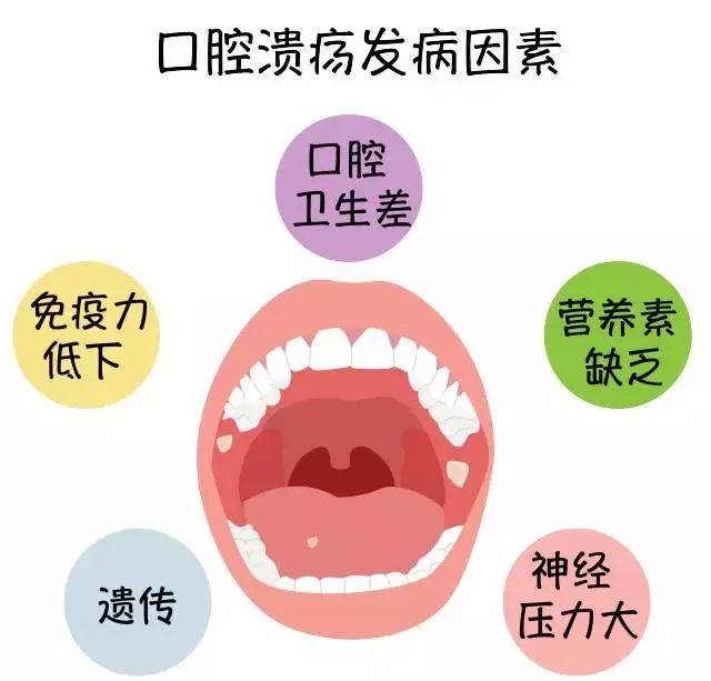 你还以为口腔溃疡是因为上火吗？