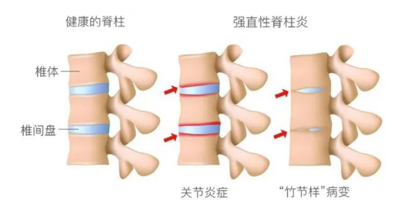 医生坦言：4种病压根无法治愈，宣称能治好的，无非只是想骗钱