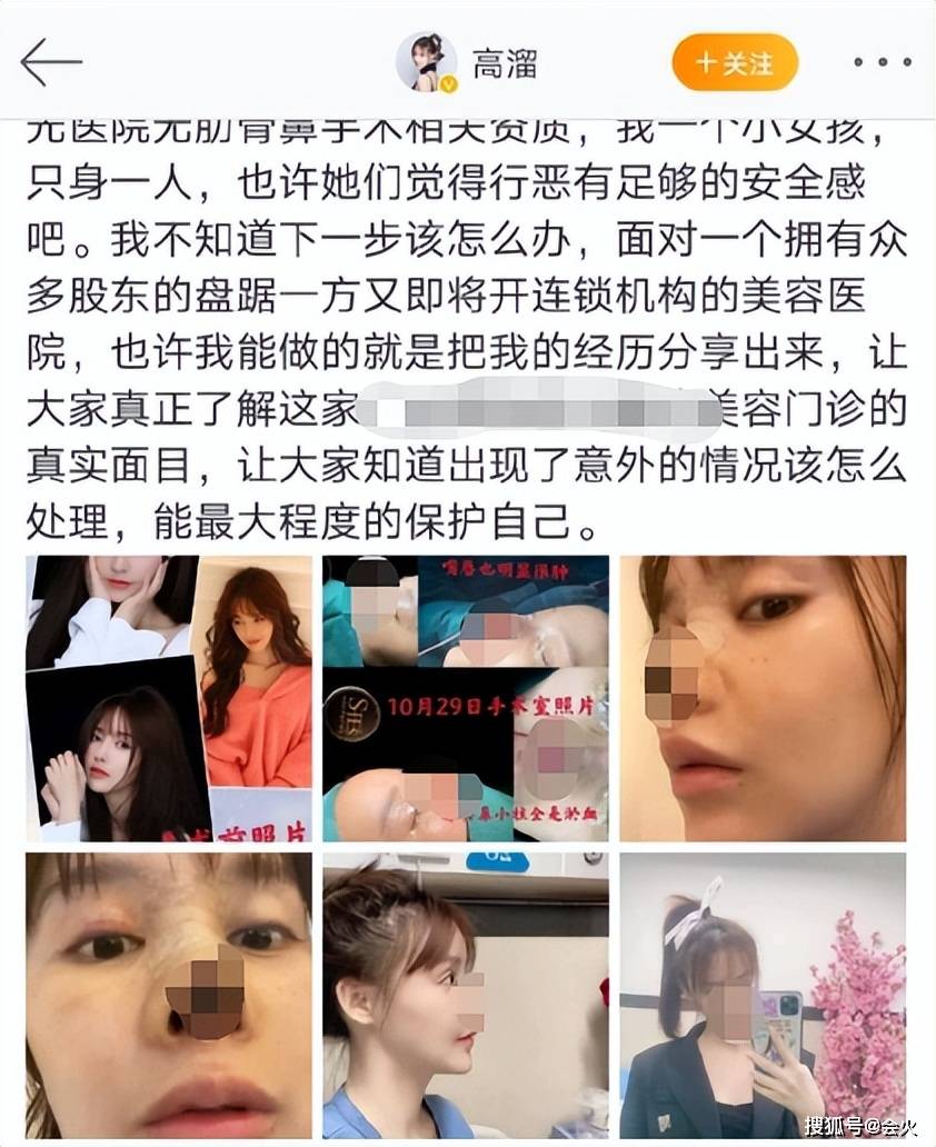 网红妮丝自曝整容失败四次！下巴尖到惊人，脸部削骨痛到后悔