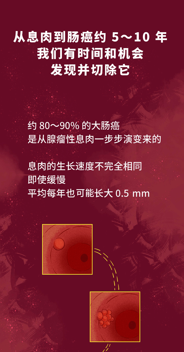 发现就是中晚期的肠癌，一个方法可以避免