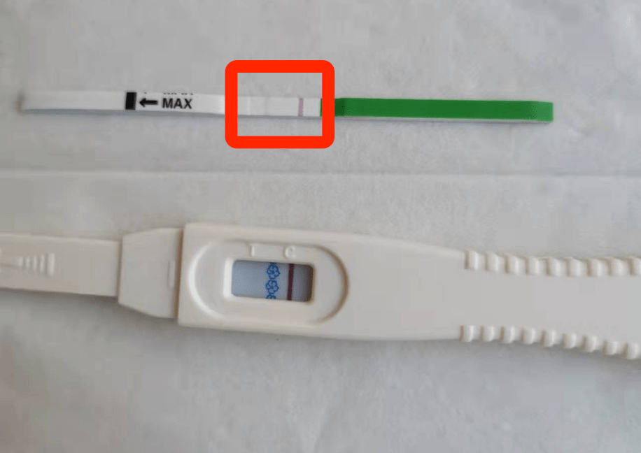 孕期尿血 6 个月，医生把 20 厘米的管子擦入我的体内