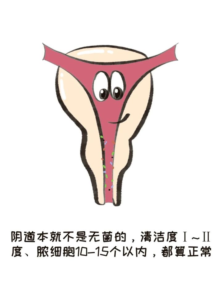 虚惊一场！这7个妇科体检报告里最常见的结果异常，都是假的