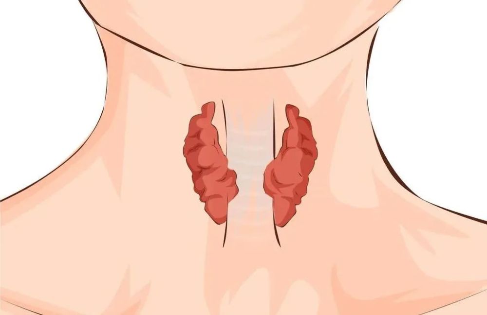 爱生气容易长甲状腺结节？因果关系你搞反了……