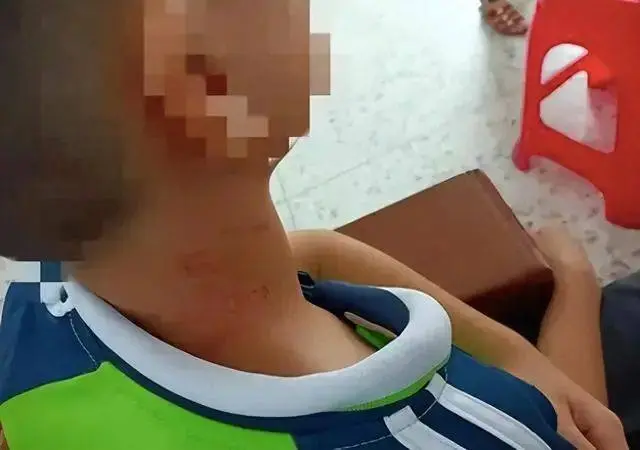 校長掐暈沒戴紅領巾男孩？家長：校長之前打過很多學生，都是私了